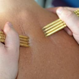 Gabinet Masażu i Chiropraktyki - Bliski kadr: Dwie dłonie używają złotych, czteropunktowych narzędzi do masażu na skórze pleców, widoczne lekkie zaczerwienienia.