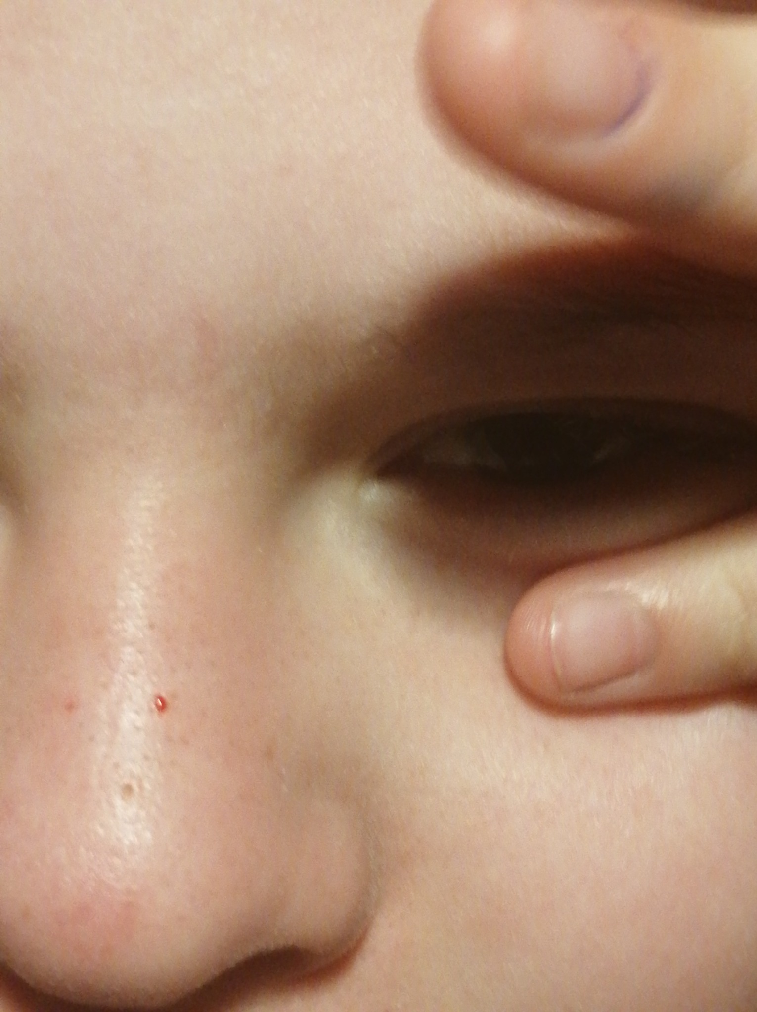 Pokrywamy koszty wizyty u lekarza okulisty .