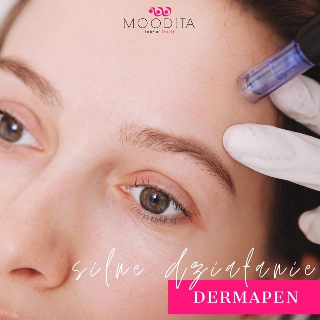 Dermapen - mezoterapia mikroiglowa
