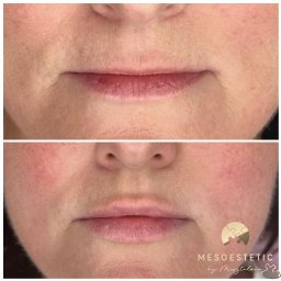 Medycyna estetyczna Tychy 1