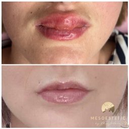 Medycyna estetyczna Tychy 2