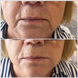 Medycyna estetyczna Tychy 4