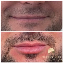 Medycyna estetyczna Tychy 3