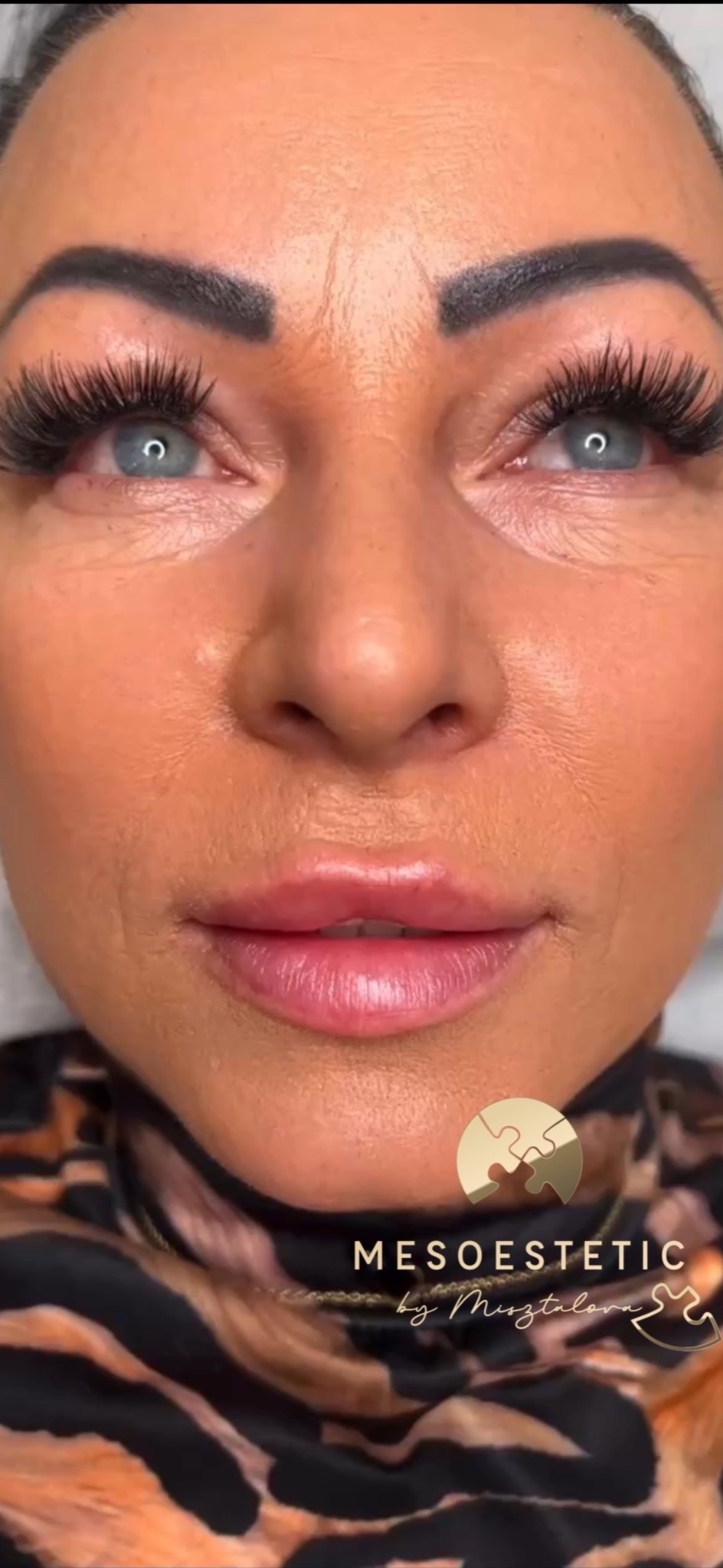 Zbliżenie na twarz kobiety po zabiegu powiększania ust i przedłużania rzęs, widoczne pełne usta i długie, gęste rzęsy, w tle logo firmy.