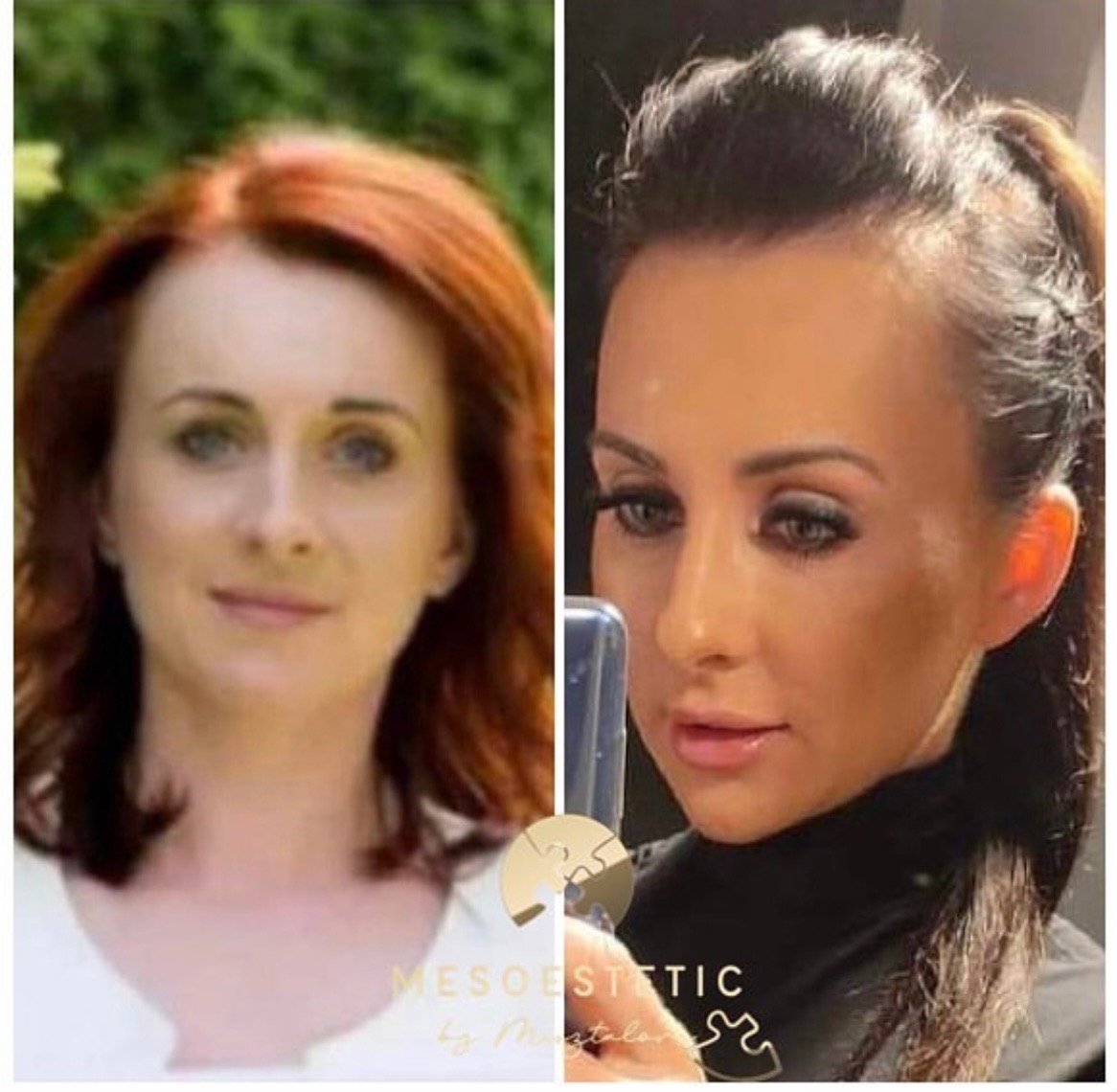 Kobieta przed i po zabiegu upiększającym, widoczna poprawa wyglądu cery i makijażu, ujęcie z bliska.