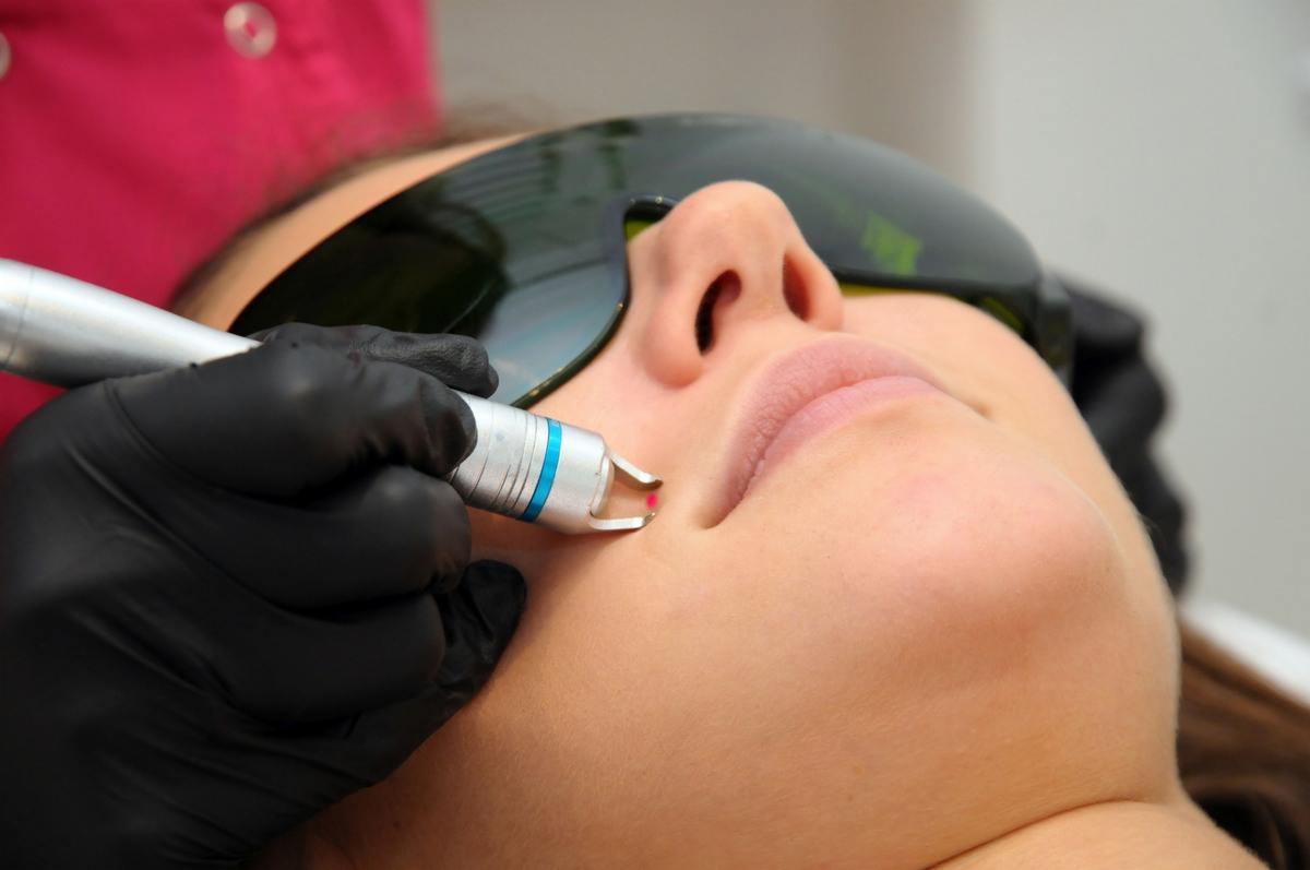 Laserowe usuwanie cellulitu na udach, brzuchu, pośladkach - Kraków. Perfect Estetic - Salon Kosmetyczny