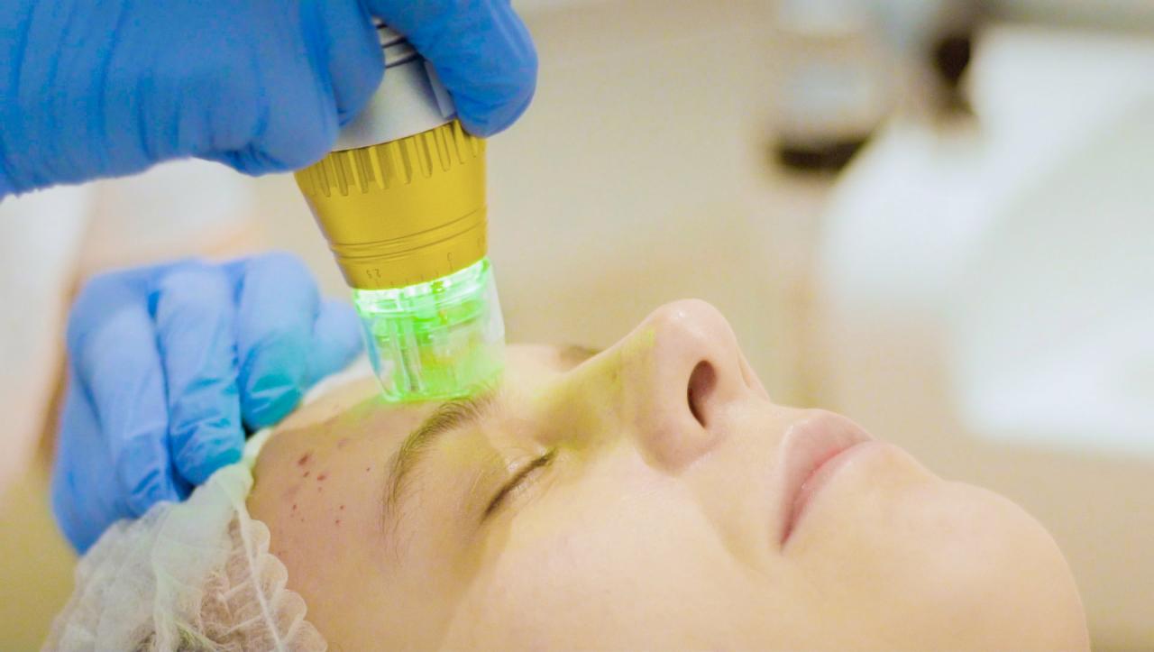 Odmładzanie skóry twarzy - Perfect Estetic. Kraków