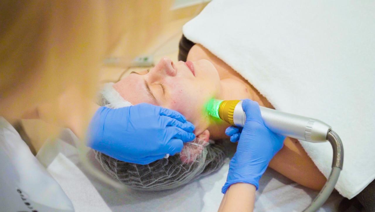 Radiofrekwencja Mikroigłowa, RF - Kraków. Perfect Estetic