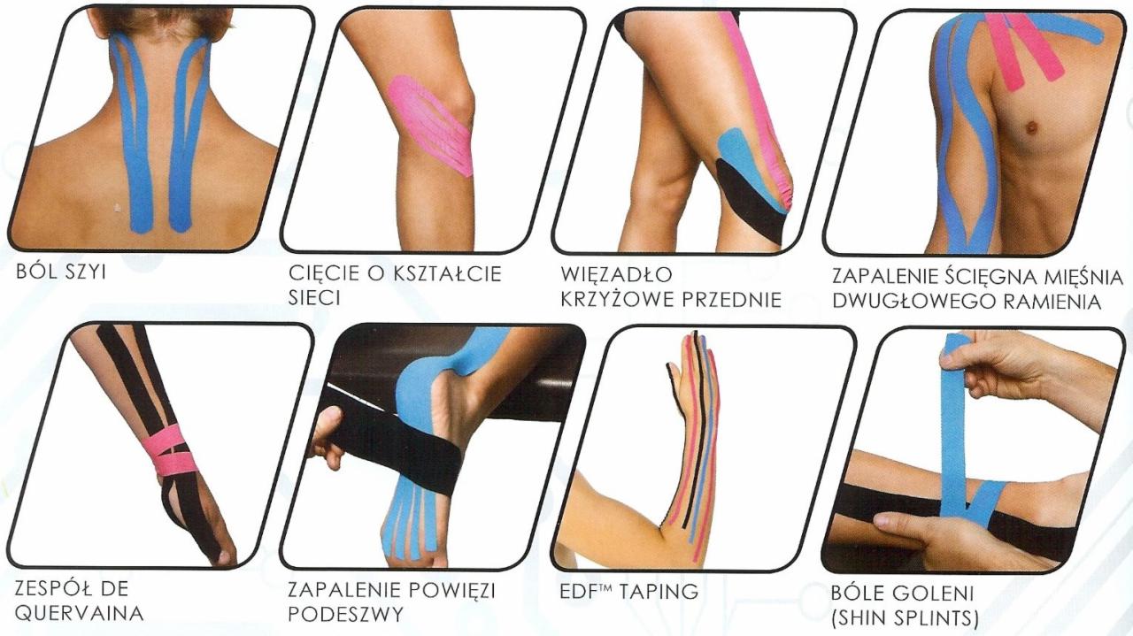 Kolaż przedstawiający różne aplikacje kinesiotapingu na ciele: szyja, kolano, ramię, stopa, nadgarstek, goleń. Taśmy w kolorach niebieskim, różowym i czarnym.
