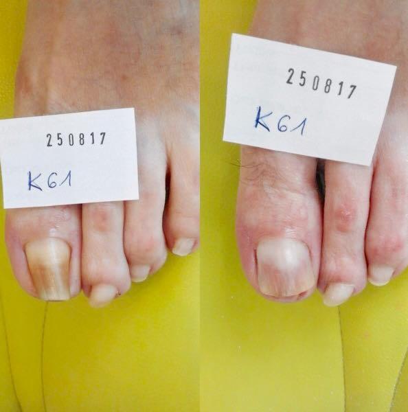 Kostka Arkady, zdjęcie przed i po