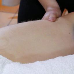masaż bańką chińską - usuwanie cellulitu