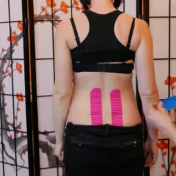 kinesiotaping - plastrowanie dynamiczne