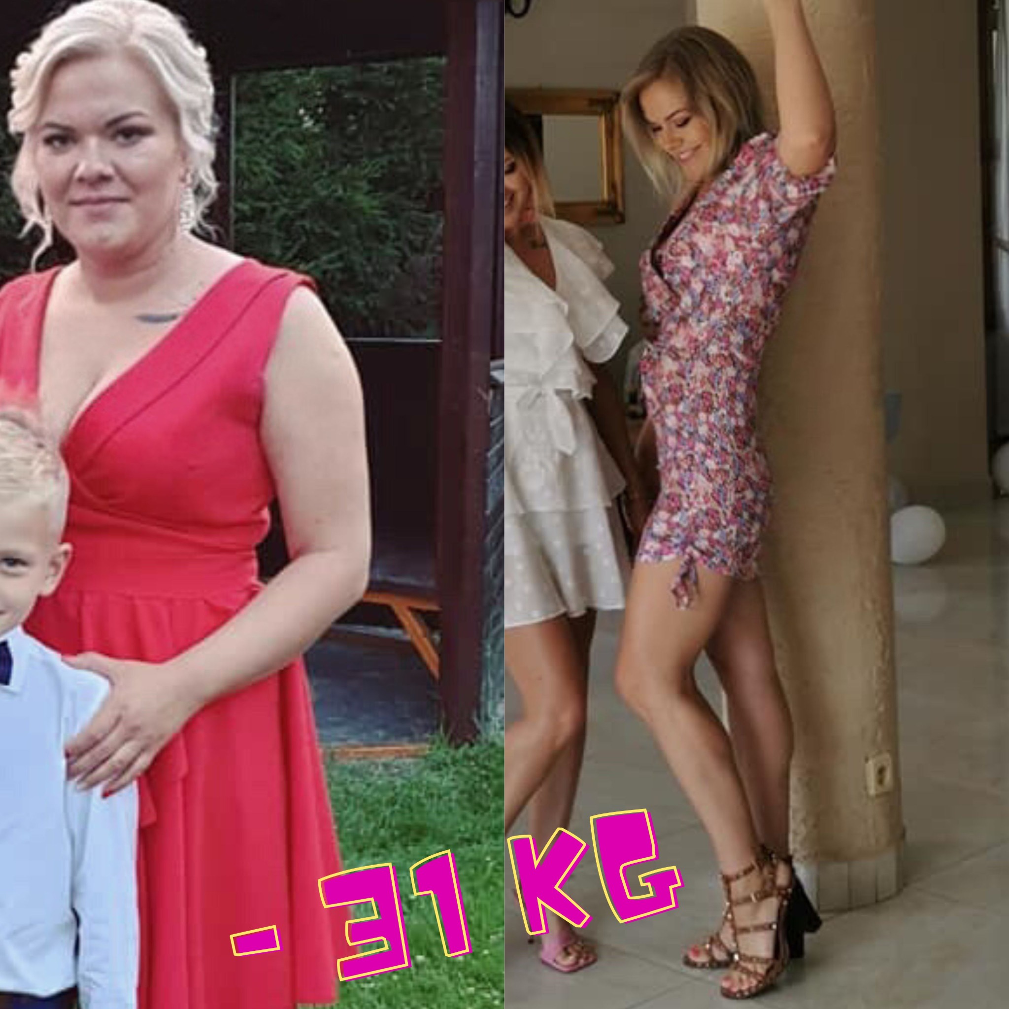 Kolaż przedstawiający kobietę przed i po utracie wagi -31 kg, ukazujący różnicę w wyglądzie i sylwetce.