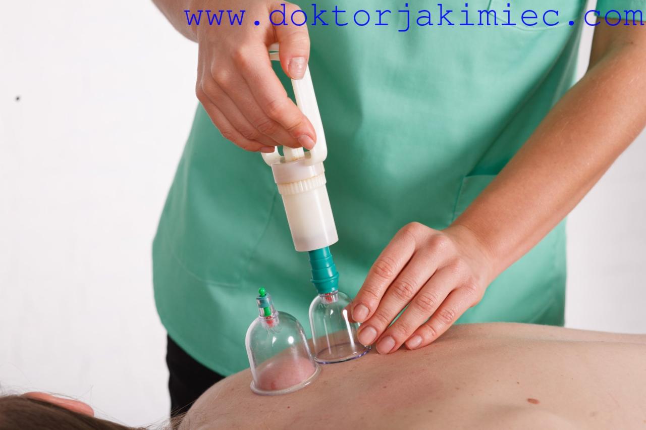 Terapeuta w zielonym uniformie aplikuje próżniowe bańki na plecy pacjenta przy użyciu plastikowej pompki.