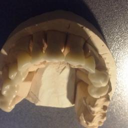 Protetyk Stare Skoszewy 2