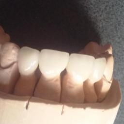 Protetyk Stare Skoszewy 3