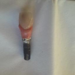 Protetyk Stare Skoszewy 4