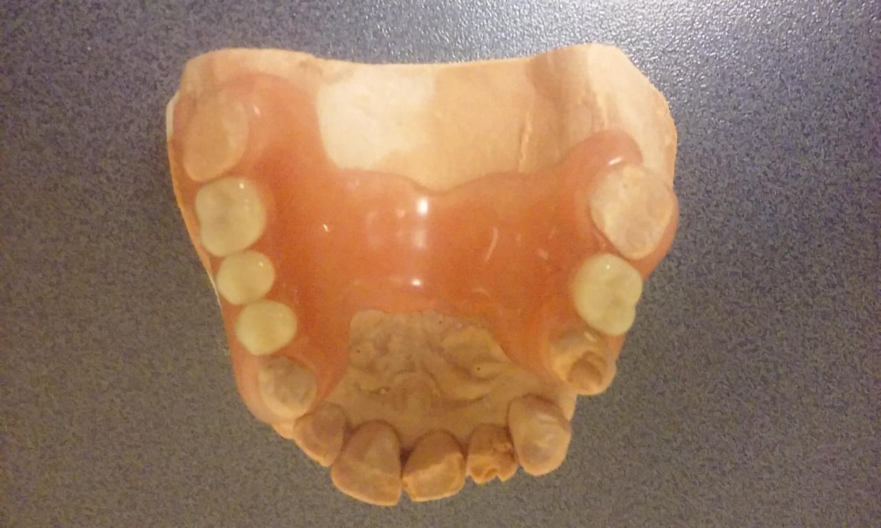 Proteza dentystyczna górna na modelu gipsowym, widok z góry na szarym tle.