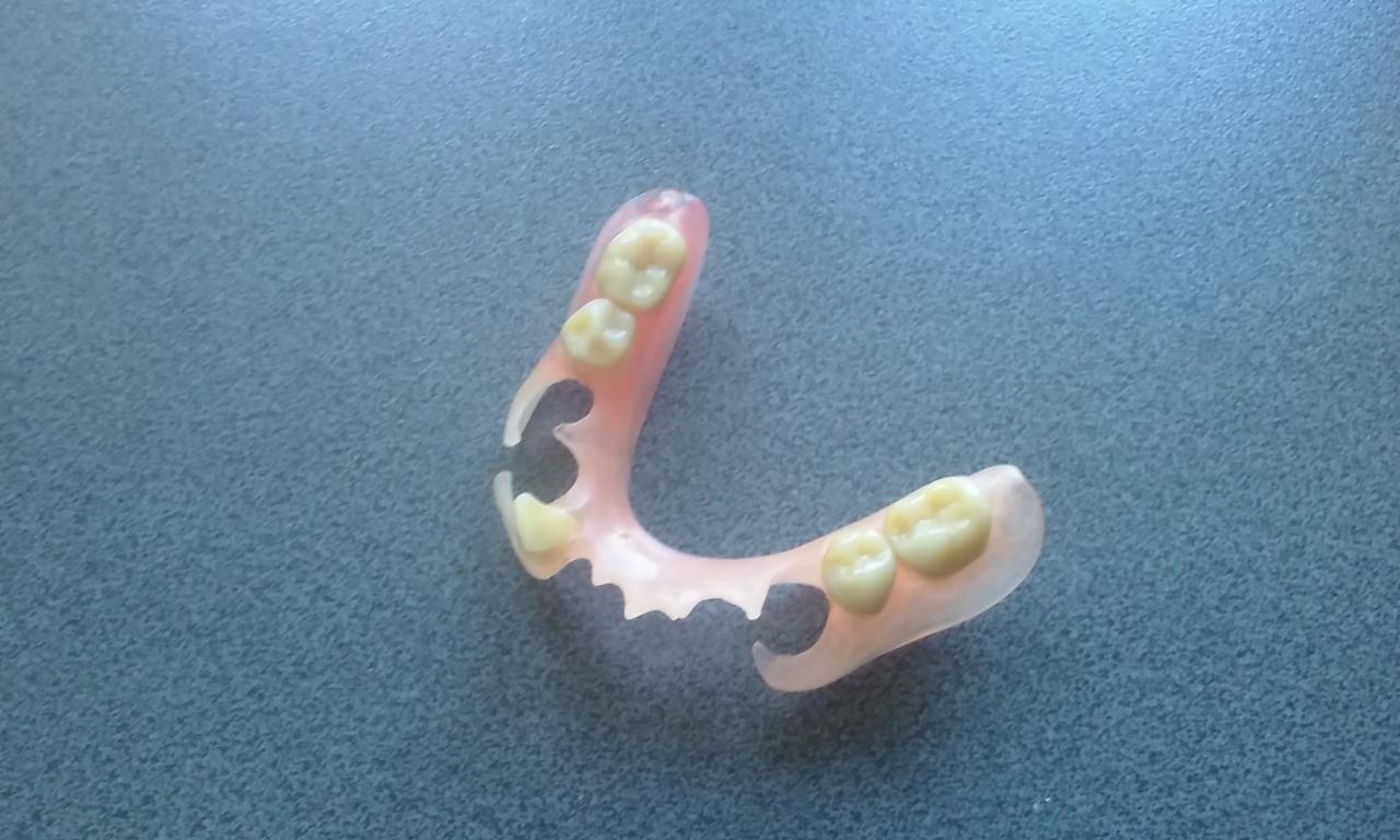 Wyjmowana proteza akrylowa z widocznymi sztucznymi zębami na szarym tle, lekko zniekształcony obraz.