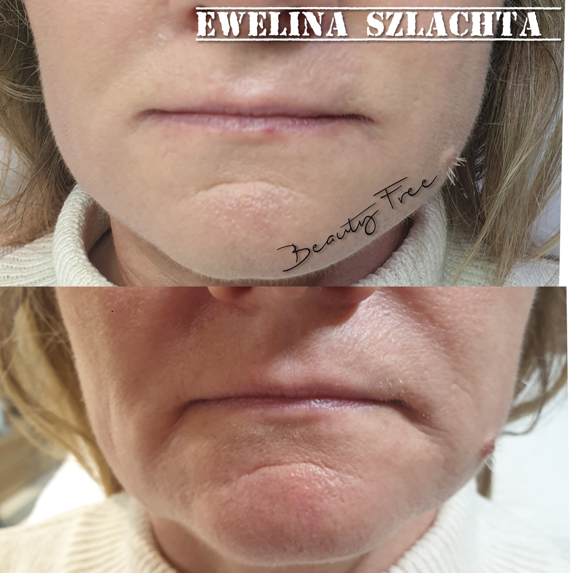 korekta marionetek! 2,5 ml młodosci