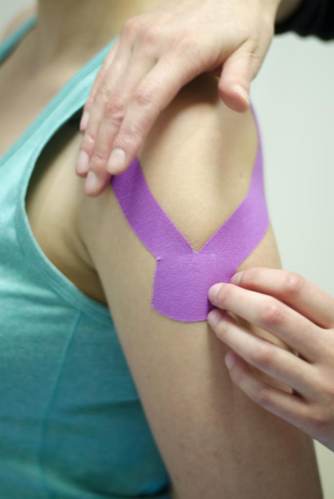 Aplikacja fioletowego kinesiotapingu na ramię pacjenta podczas zabiegu. Widoczne dłonie terapeuty i fragment turkusowej koszulki.