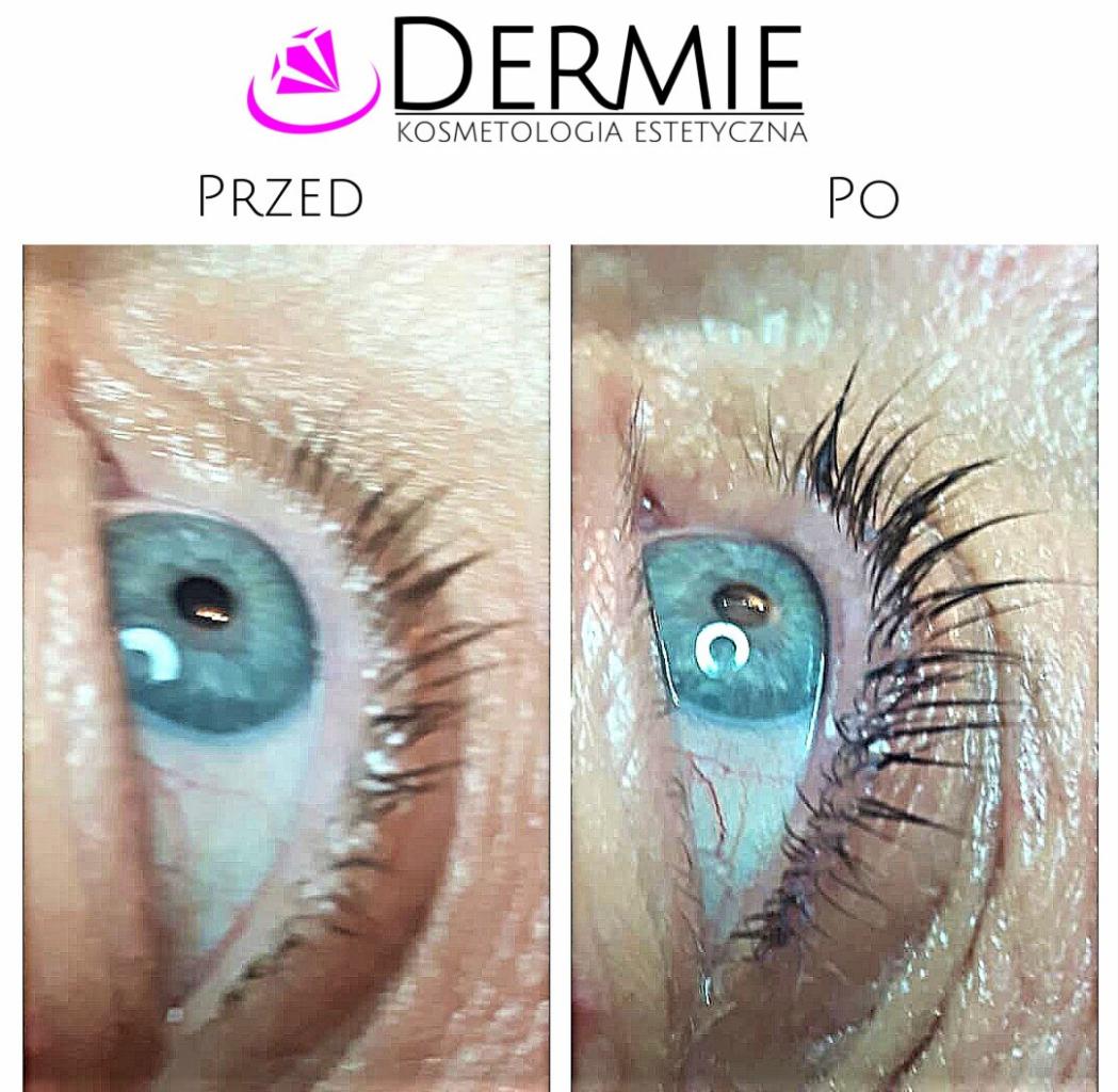 Keratynowy lifting rzęs