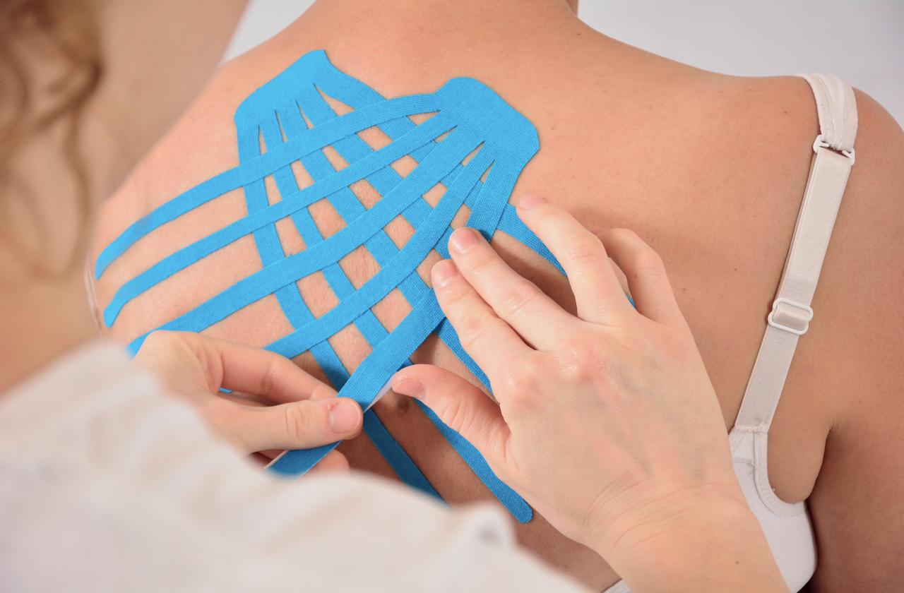 Aplikacja niebieskich taśm kinesiotaping na plecach pacjenta, widoczne dłonie terapeuty naklejające taśmę w okolicy łopatki.
