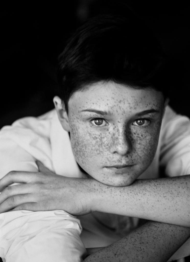 Czarno-biały portret młodego mężczyzny z piegami, opierającego brodę na skrzyżowanych ramionach, patrzącego wprost w obiektyw.