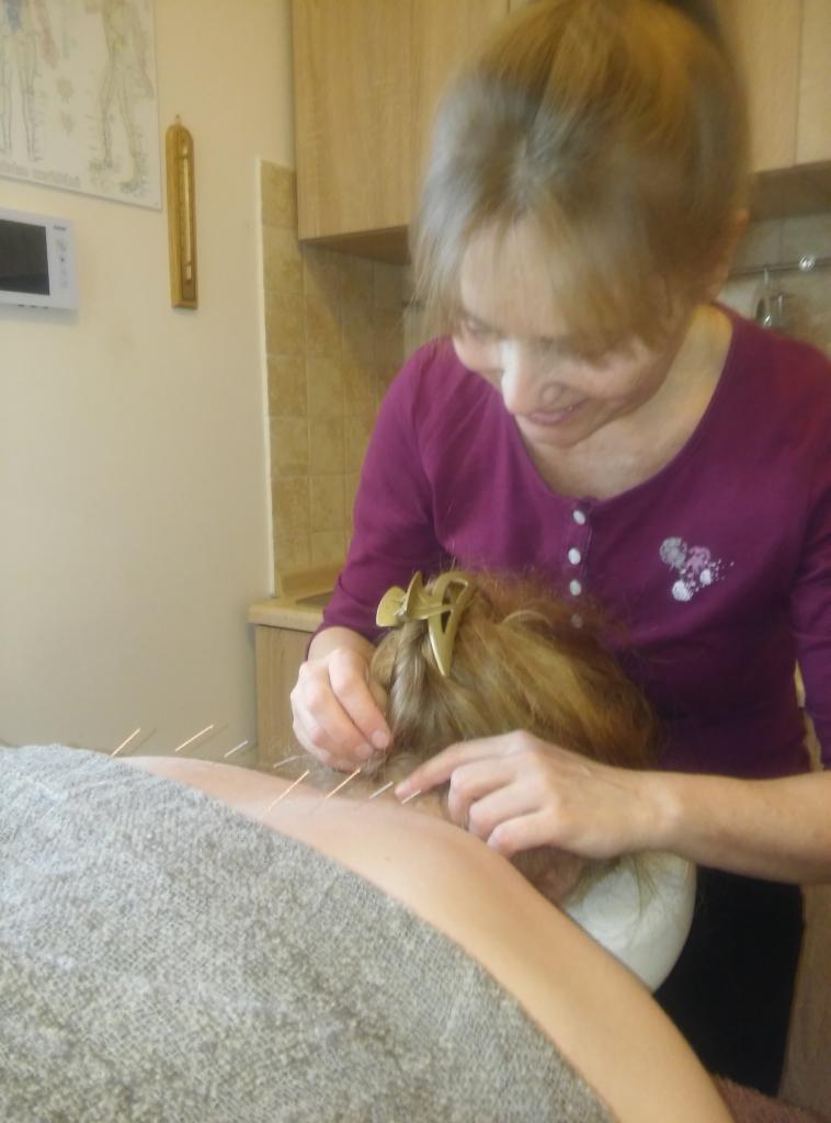 Kobieta w bordowej bluzce aplikuje igły na szyję pacjentki leżącej na szarym ręczniku, widoczne igły i złota spinka we włosach pacjentki.