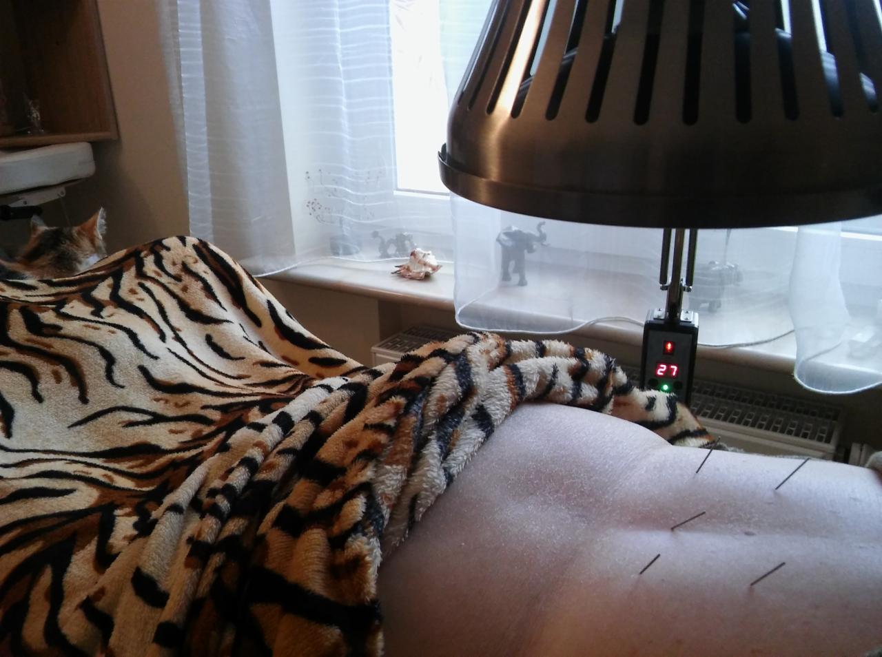 Plecy pacjenta z igłami do akupunktury, przykryte kocem w tygrysie paski, pod lampą grzewczą z wyświetlaczem temperatury, w tle okno z figurkami słonia i muszelki, oraz częściowo widoczny kot.