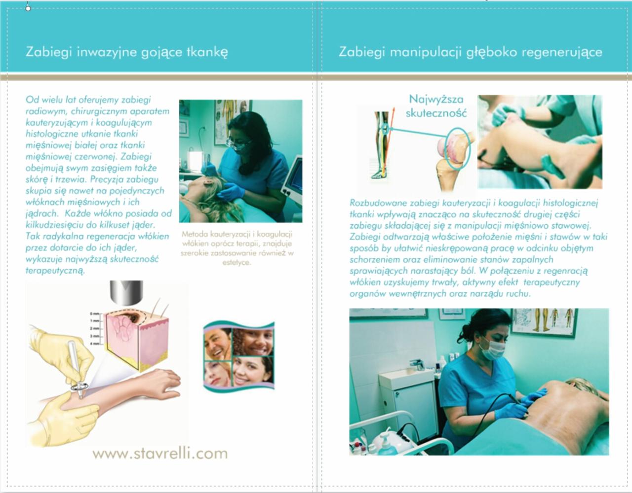 Kolaż informacyjny prezentujący zabiegi inwazyjne i regenerujące tkanki, z ilustracjami i zdjęciami pacjentów podczas zabiegów kauteryzacji i koagulacji w prywatnej klinice.