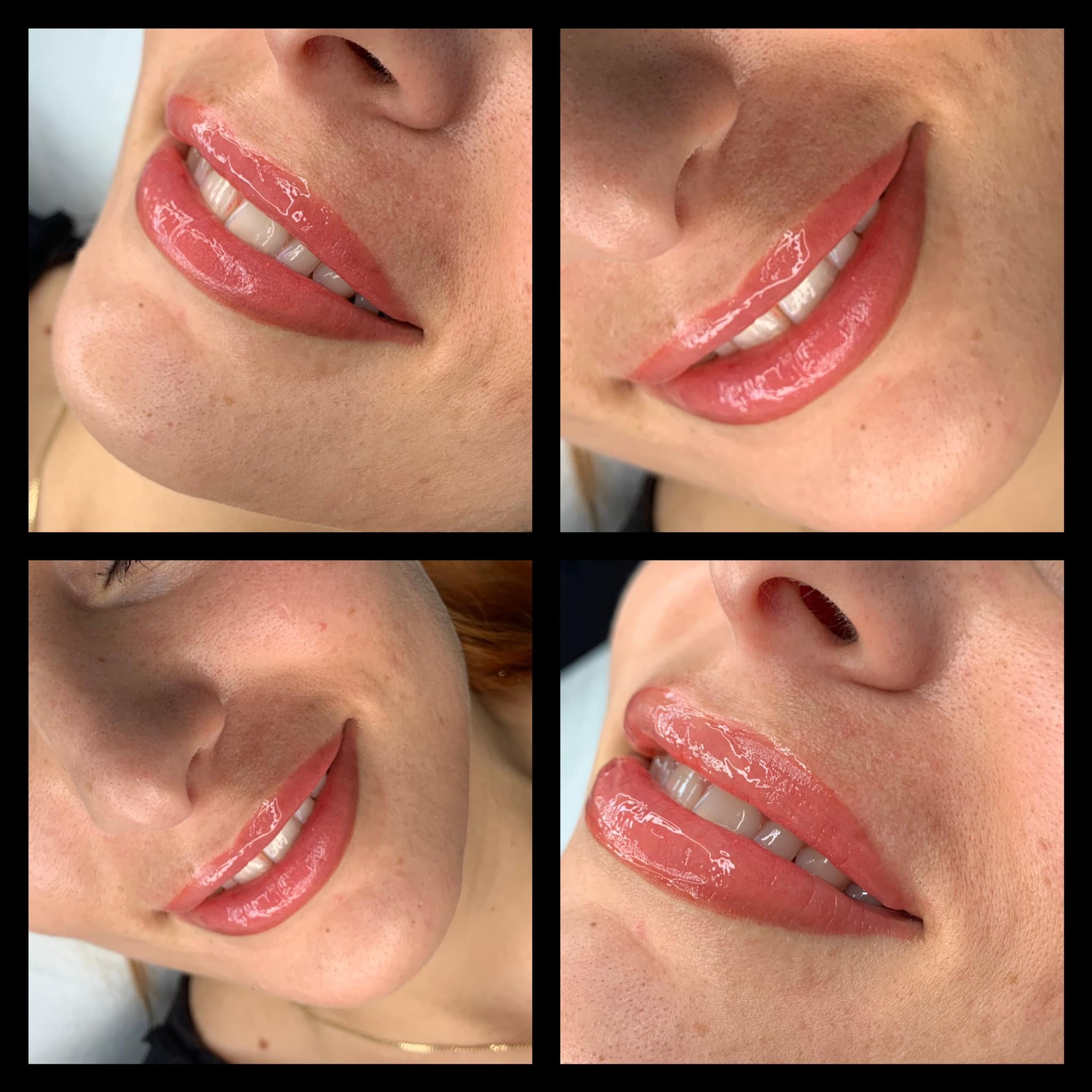 Cztery zbliżenia na usta po zabiegu pigmentacji, z widocznym błyszczącym, koralowym kolorem i podkreślonym konturem, prezentujące efekt wizualny z różnych perspektyw.