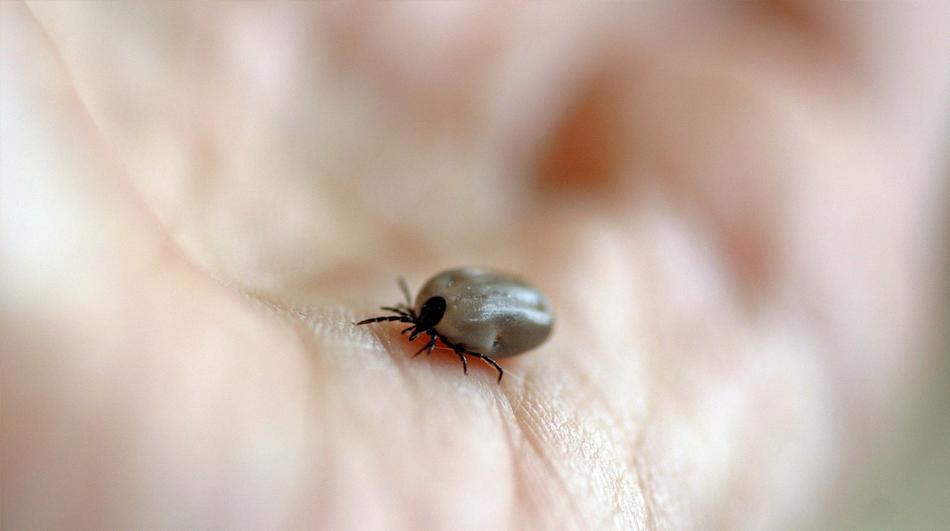 Powiększone zdjęcie kleszcza na ludzkiej skórze, widoczne czarne odnóża i nabrzmiałe ciało pasożyta.