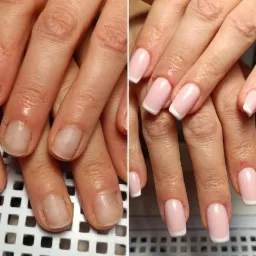 Porównanie dłoni przed i po wykonaniu manicure hybrydowego french. Po lewej dłoń z naturalnymi, niepomalowanymi paznokciami, po prawej dłoń z paznokciami pomalowanymi na jasnoróżowo z białymi...