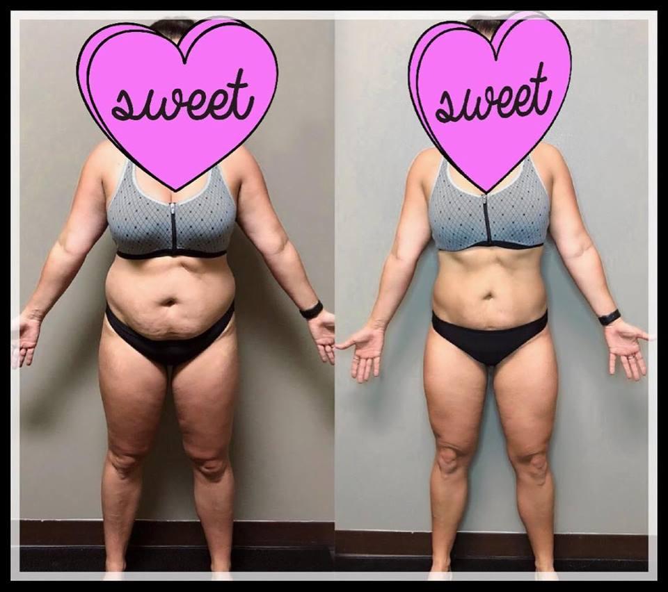 Kobieta w bieliźnie sportowej, widoczne porównanie sylwetki przed i po, z zaznaczoną różnicą w wyglądzie brzucha i ud, z twarzą zasłoniętą naklejką w kształcie serca z napisem 'sweet'.