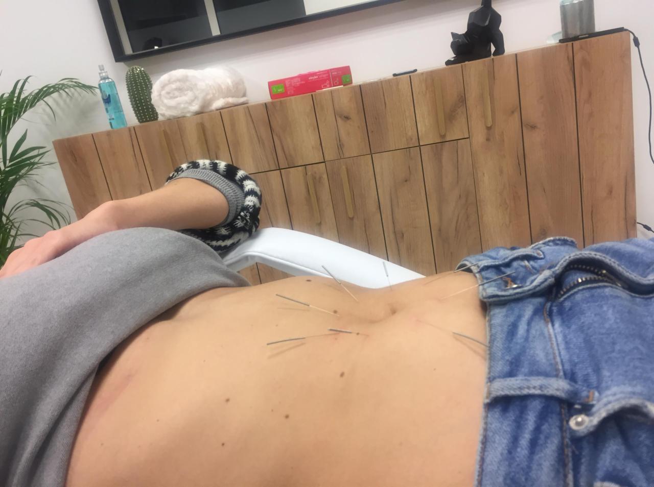 Pacjentka leżąca na białym leżaku z igłami do zabiegu w okolicy brzucha, ubrana w dżinsy i szarą bluzę, widoczny fragment drewnianej szafki i rośliny doniczkowej w tle.