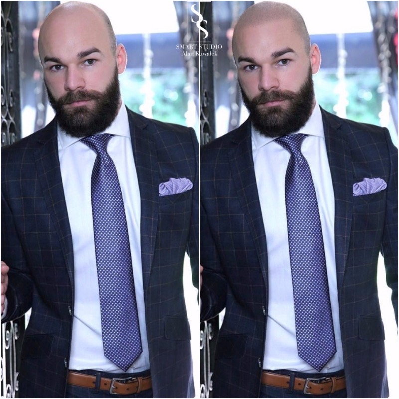 Mężczyzna w garniturze z widoczną mikropigmentacją skóry głowy, prezentujący efekt zagęszczenia włosów.