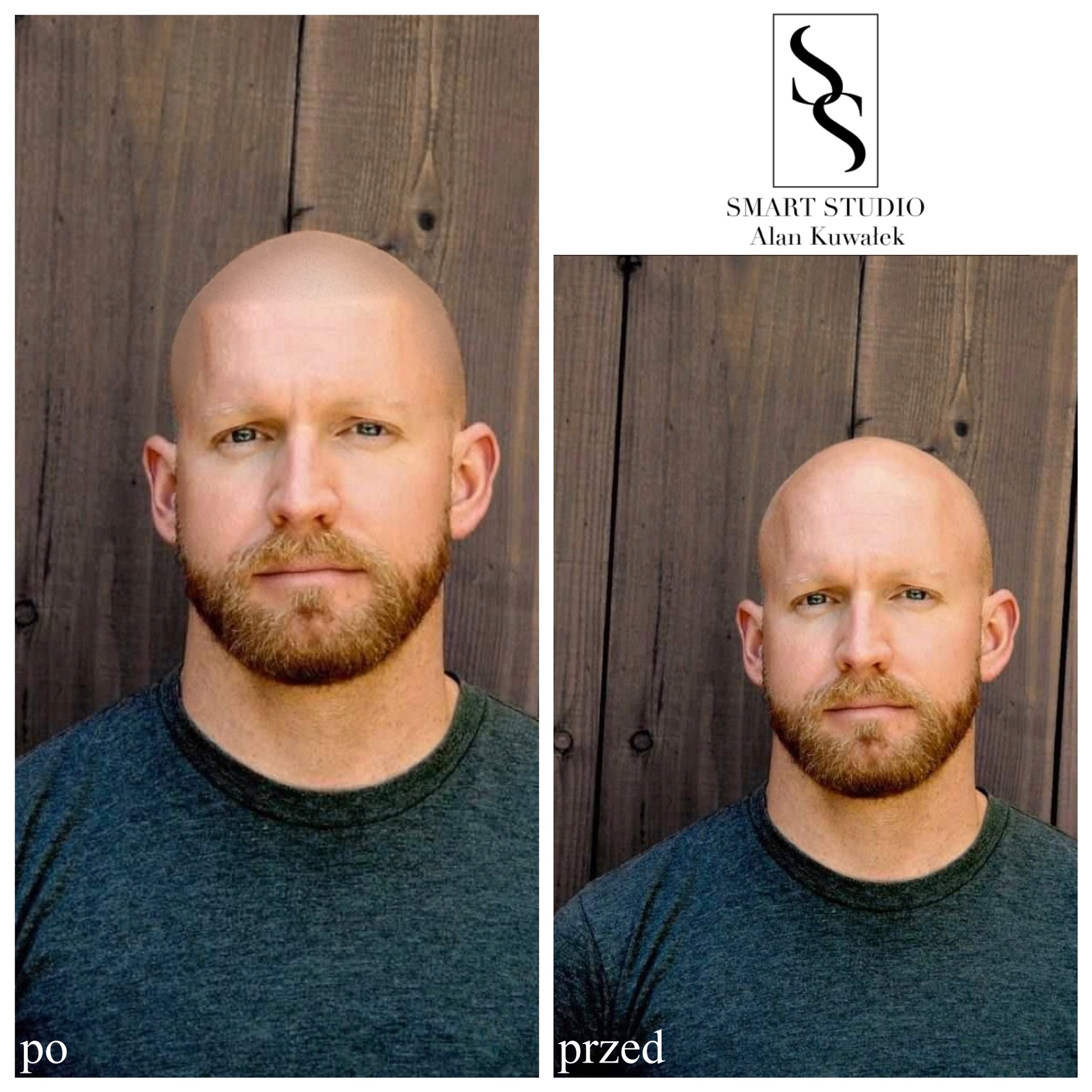 📍📍MIKROPIGMENTACJA SKÓRY GŁOWY📍📍 Zapraszamy do kontaktu w sprawie wizualizacji online📞