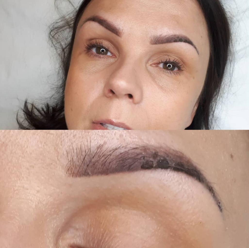 Zbliżenie na twarz kobiety z widocznymi brwiami po zabiegu makijażu permanentnego; widoczny obszar gojenia się skóry w górnej części brwi.