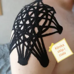 Kinesiotaping, ulga w bólu