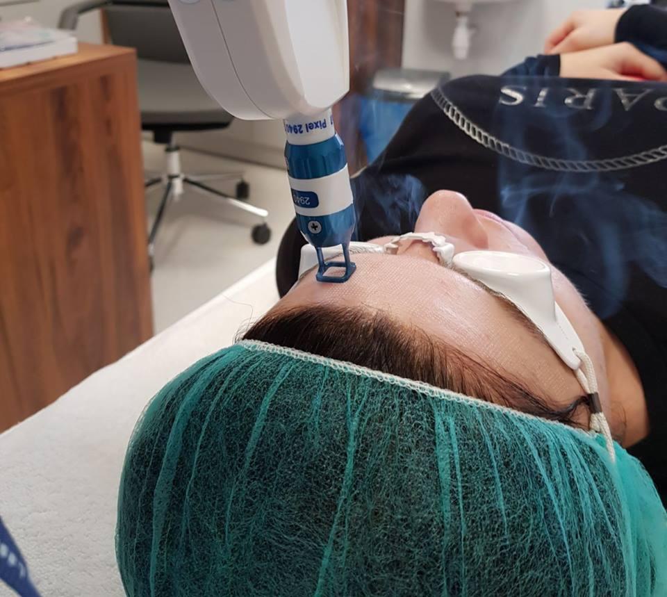 Zabieg laserowy na czole pacjentki w czepku i okularach ochronnych, widoczny aplikator lasera Pixel 2940.