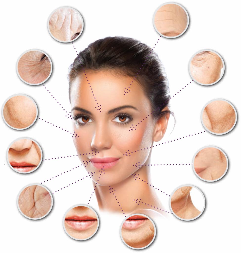 Portret kobiety z zaznaczonymi obszarami twarzy w kółkach, prezentującymi zmarszczki i zmiany skórne.