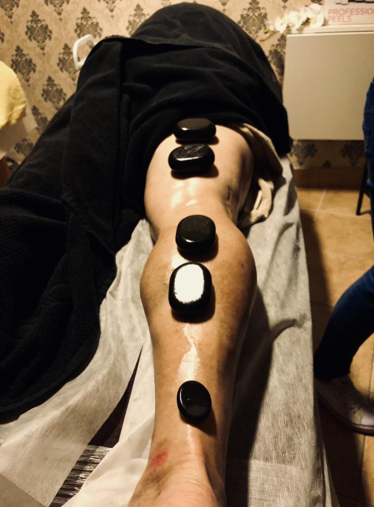 Masaż gorącymi kamieniami na łydce, jeden kamień z białą powłoką, widoczne zaczerwienienie skóry, tło z wzorzystą tapetą.