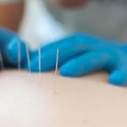 Suche Igłowanie Kraków