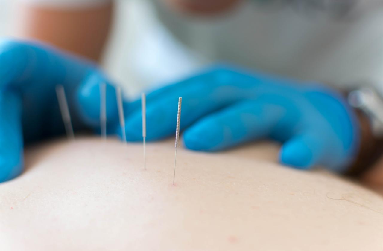 Suche Igłowanie Kraków