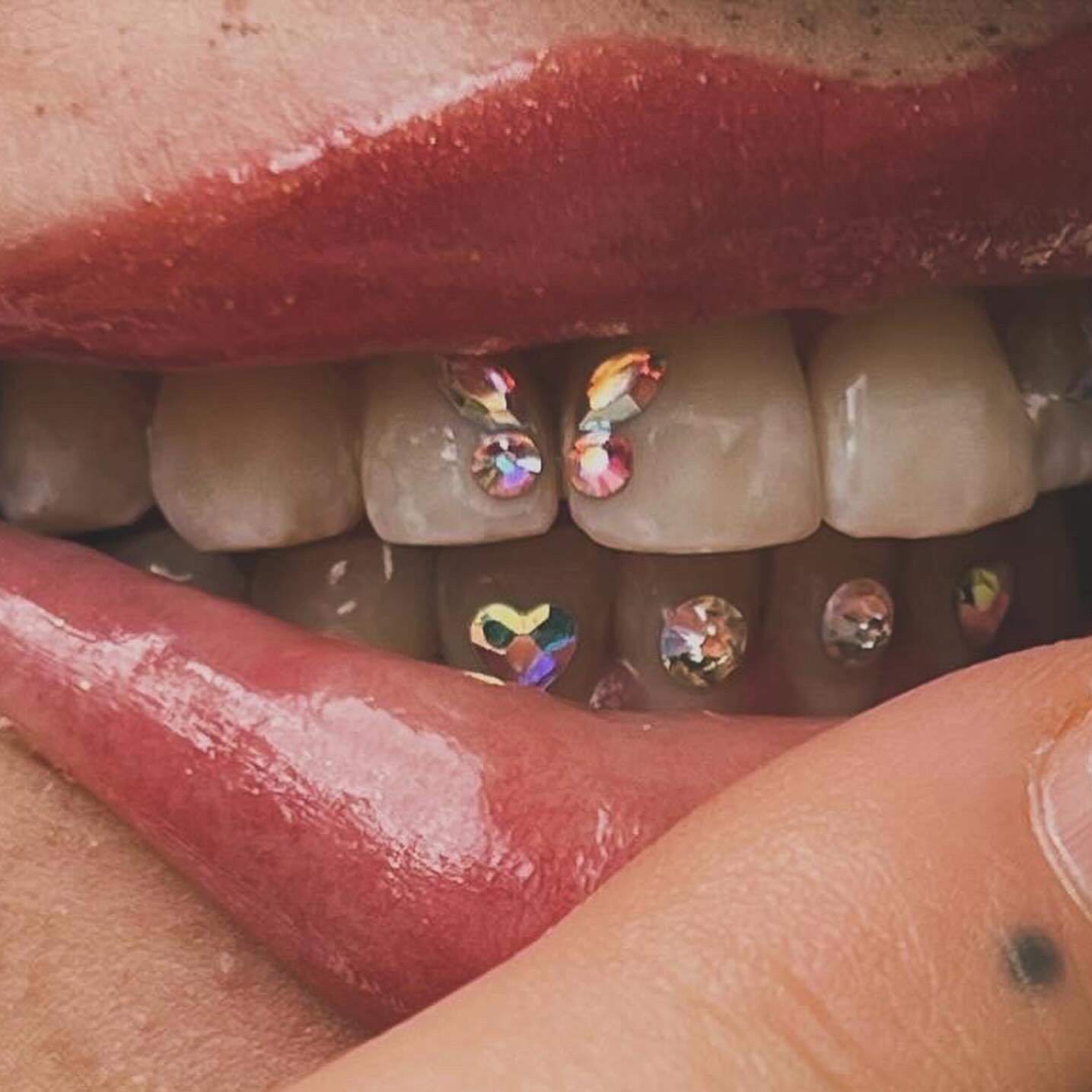 Zbliżenie na usta z błyszczącymi kryształkami na zębach, ułożonymi w różne kształty, w tym serce i motyl.