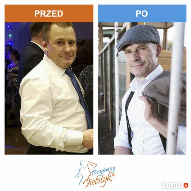 Mężczyzna przed i po diecie: po lewej stronie twarz okrągła, ubrany w koszulę i krawat, po prawej stronie twarz szczuplejsza, w kaszkiecie i koszuli z szelkami, trzymający marynarkę.