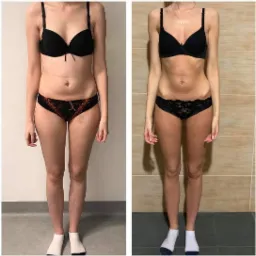 Kobieta w bieliźnie, prezentująca porównanie sylwetki przed i po, widoczne zmiany w obwodzie talii i ud, na tle dwóch różnych ścian.