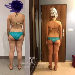 Zdjęcie przedstawia porównanie sylwetki kobiety w bikini przed i po interwencji, widok z tyłu, z głową zamaskowaną na lewym zdjęciu i z ręcznikiem na głowie na prawym zdjęciu, z widocznym logo...