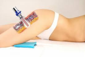 Kobieta leżąca na boku w białej bieliźnie, poddawana zabiegowi na ciało z użyciem urządzenia z metalową końcówką i kolorową nakładką na udzie, na białym tle z niebieskim podkładem